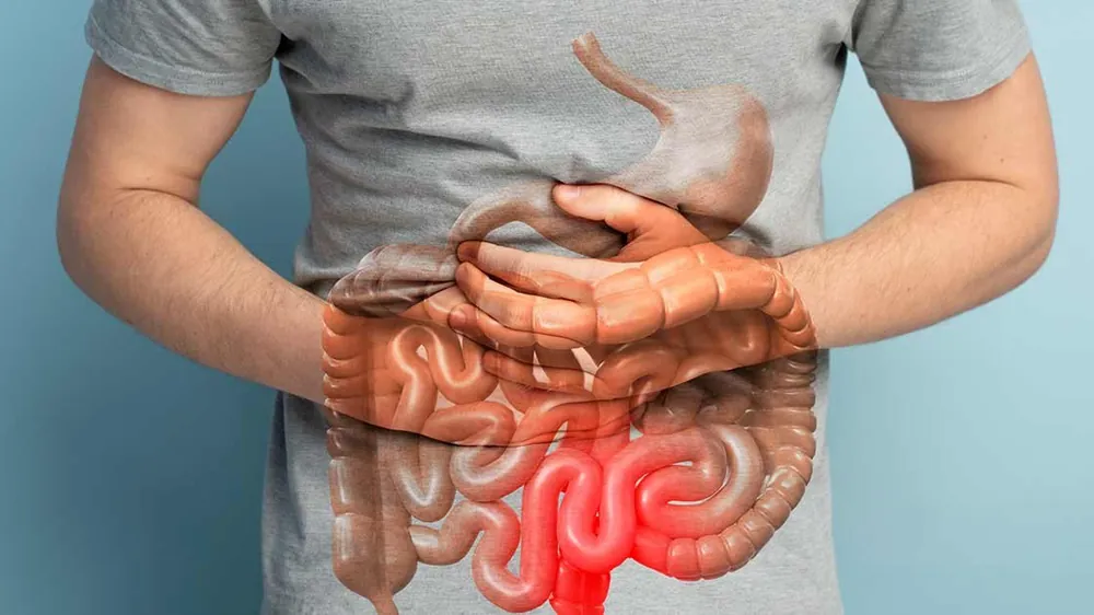 Intestino preso