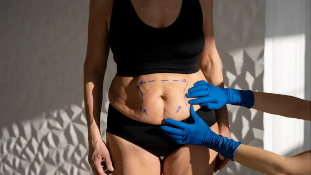Obesidade como Doença: Quando a Cirurgia do Aparelho Digestivo se Torna Necessária